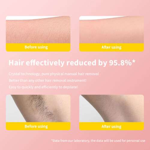 Painless Crystal Hair Remover for Smooth Arms, Legs, & Skin - Reusable & Exfoliating