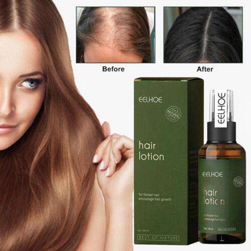 FollicleRX NMN Follicle Reverse Serum: Revitalize Hair Growth and Reverse Follicle Aging with 100ML of Powerful NMN Serum.