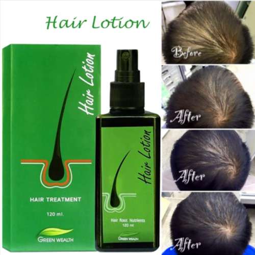 120ml Green Wealth Hair Growth Lotion: Stop Hair Loss & Stimulate Root Growth for Thicker, Fuller Sideburns