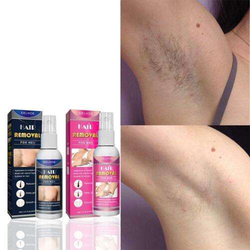 Permanent Painless Hair Removal: Super Effective Whole Body Depilatory Cream