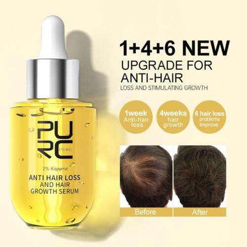 Accelerate Hair Growth with Ginger Essence Oil: Fast Regrowth & Anti-Loss Treatment