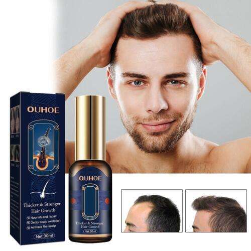 Polygonum Multiflorum Hair Growth Serum Spray for Men & Women - 30ml