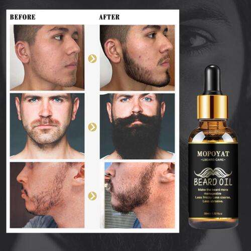 Beard Growth Essential Oil Serum: Faster, Fuller Facial Hair for Men