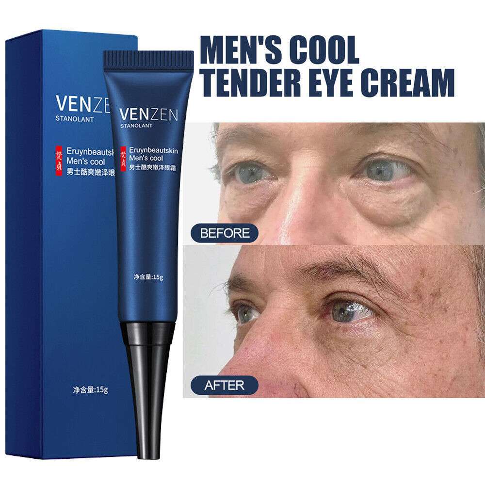 Anti-Aging Eye Cream Serum with Retinol: Lift, Firm, & Reduce Dark Circles and Eye Bags