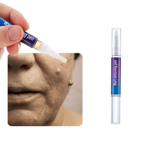 Wart Removal Pen: Eliminate Skin Tags, Foot Corns, and Warts - Unisex Solution, 3ml