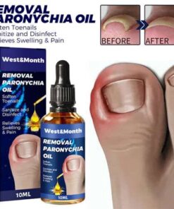Anti-Paronychia, Ingrown Toenail & Onychomycosis Relief Oil: Fast-Acting, Natural Treatment for Pain & Infection