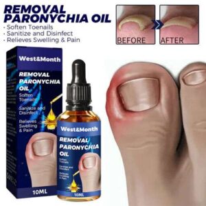 Anti-Paronychia, Ingrown Toenail & Onychomycosis Relief Oil: Fast-Acting, Natural Treatment for Pain & Infection