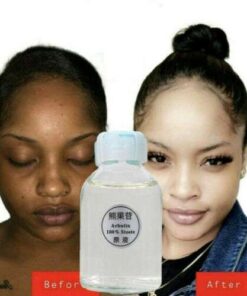 Brighten and Glow: Kojic Acid Serum for a Radiant, Even Complexion