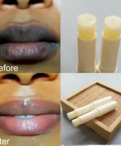Fast Lip Lightening Cream: Remove Dark Lips, Reveal Pink, Fresh, Healthy Lips.