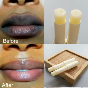 Fast Lip Lightening Cream: Remove Dark Lips, Reveal Pink, Fresh, Healthy Lips.