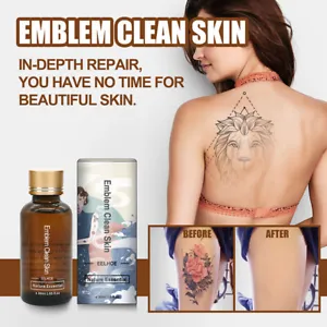 Natural Tattoo Removal Cream: Safely Bleach and Correct Pigment