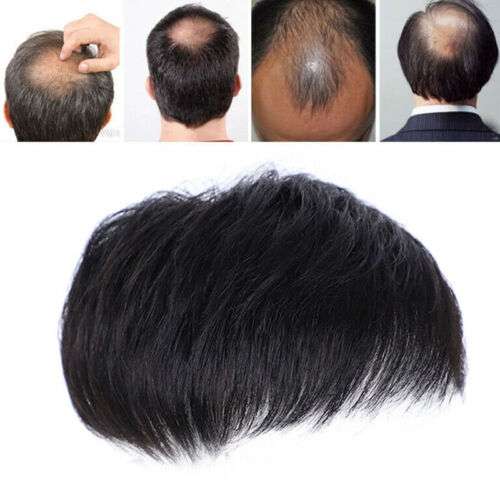 Men's Black Natural Human Hair Topper for Instant Hair Volume and Coverage
