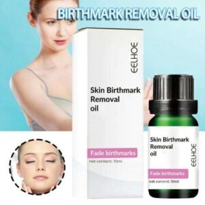 चेहरे के हाइपरपिग्मेंटेशन को हल्का करने के लिए शक्तिशाली त्वचा बर्थमार्क हटाने वाला तेल