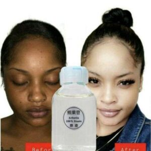 إشراقة وتوهج: سيروم حمض الكوجيك لبشرة مشرقة وموحدة اللون