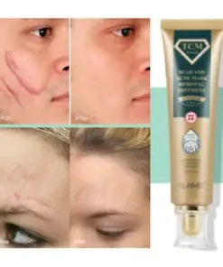 Acne Scar Removal Cream Gel: Erase Scars, Stretch Marks & Restore Smooth Skin