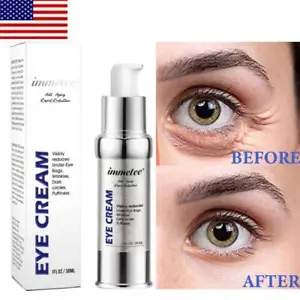 Advanced Eye Cream: Combating Dark Circles, Crows Feet, and Puffiness for Firmer, Younger-Looking Skin