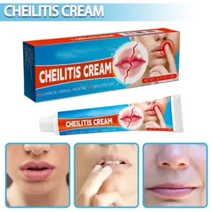 Effective 20g Cheilitis Cream for Dry, Cracked, Peeling, and Bleeding Lips