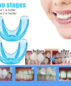 2-Stage Dental Braces Teeth Trainer: Align Your Teeth and Achieve a Beautiful Smile.