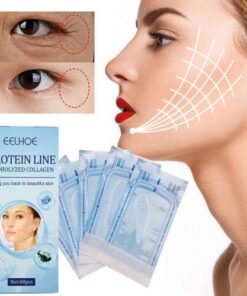 ProFirm Korean Soluble Protein Thread Instant Lifting Set: Absorbable Threads for Threading