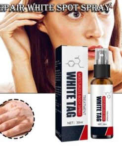 White Spot Antibacterial Spray: Fight Leukoplakia and Vitiligo for Radiant Skin