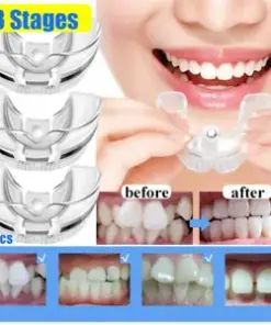 1+2+3 Stages Dental Orthodontic Teeth Corrector Braces for Straightening and Retaining Teeth