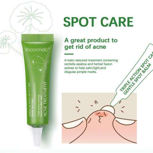 Herbal Acne Treatment Cream: Clear Pimples, Reduce Oil, and Restore Balanced Skin.