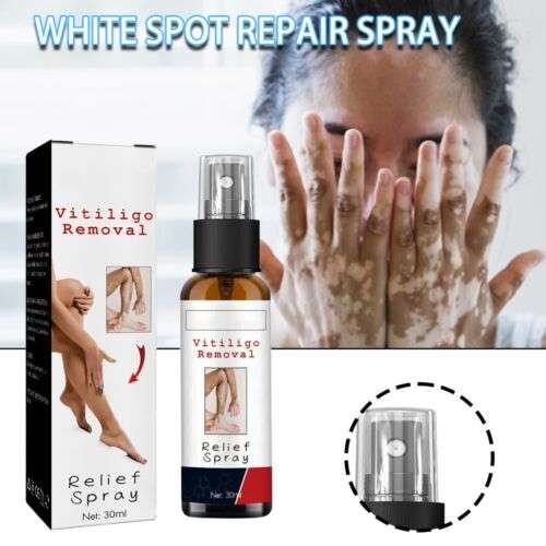 Vitiligo Remedy: 30ml Spray for White Spot Relief and Leukoplakia Diminishment