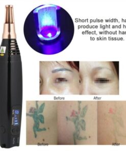 Advanced Portable Picosecond Pen for Precise Scar and Tattoo Removal with Laser Therapy