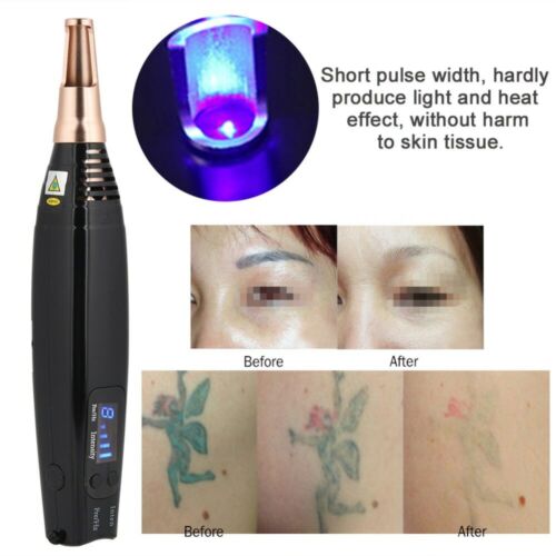 Advanced Portable Picosecond Pen for Precise Scar and Tattoo Removal with Laser Therapy