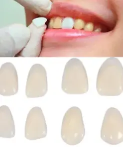 Instant Smile Cosmetic Dental Teeth Veneers - Temporary Tooth Repair Kit for Missing, Chipped, Broken Teeth