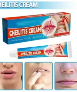Effective 20g Cheilitis Cream for Dry, Cracked, Peeling, and Bleeding Lips
