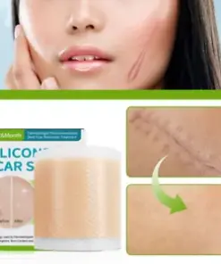 Medical Grade Silicone Scar Tape: Reduce Hyperpigmentation & Keloids, Promote Healing.