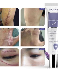 Scar Removal Cream: Repairing Burns, Scratches, Pimples, & Scars for All Skin Types