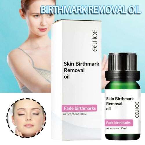 Powerful Skin Birthmark Removal Oil for Lightening Face Hyperpigmentation