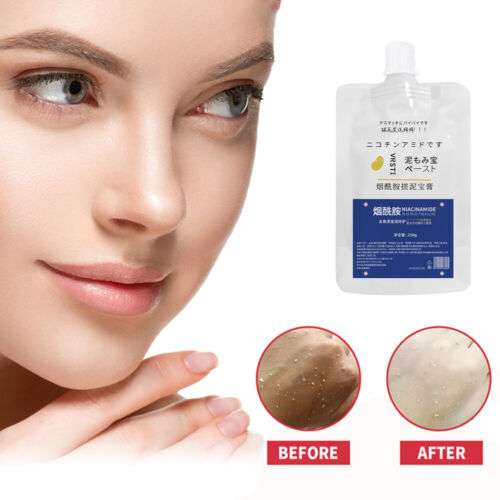 Ultra-Exfoliating Nicotinamide Body Gel: Instantly Brighten and Renew Your Skin with 250g of Radiant Rubbing Treasure